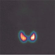 radio_41