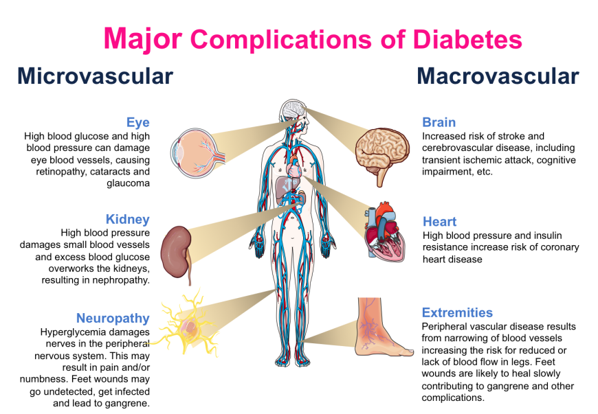 Major Complications of Diabetes