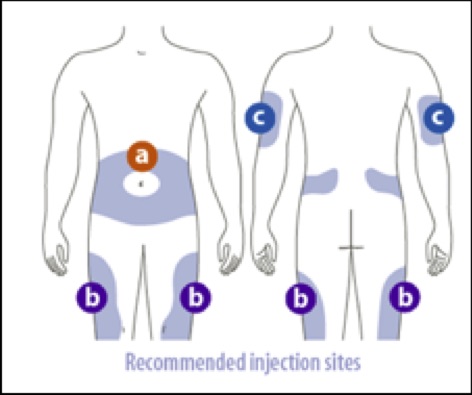 diabetes injection sites