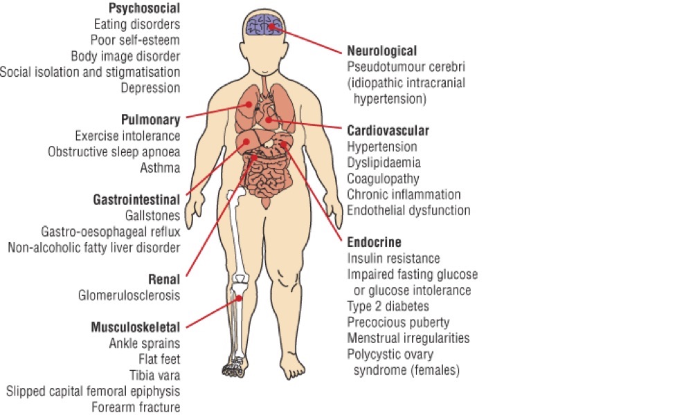 health consequences of regional obesity