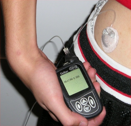 Insulin Pump - image source Wikipedia