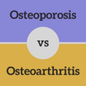Osteoporosis vs Osteoarthritis