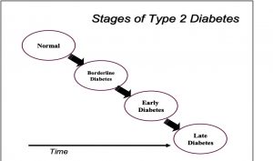 Stages of Type 2 Diabetes