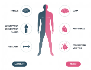 hypercalcaemia