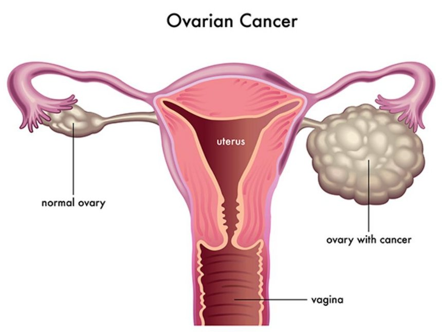 Ovary