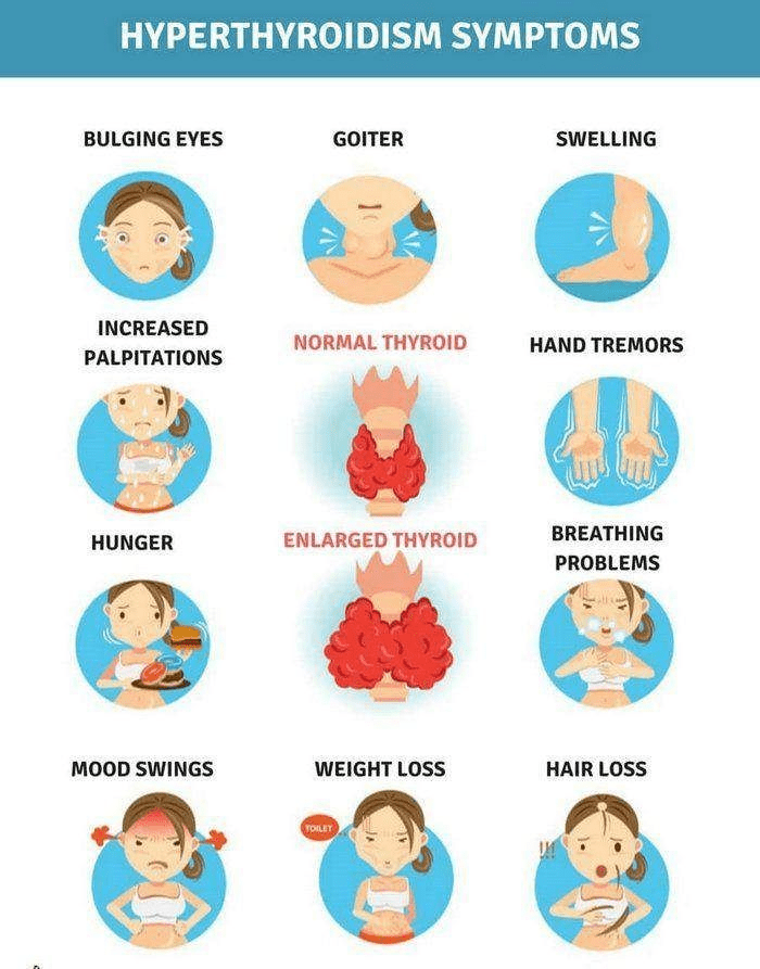 hyperthyroidism symptoms